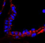 EGFR Antibody in Immunohistochemistry (Paraffin) (IHC (P))