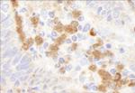 G6PD Polyclonal Antibody