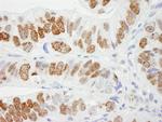 H2AX Antibody in Immunohistochemistry (Paraffin) (IHC (P))