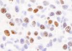 H2AX Antibody in Immunohistochemistry (Paraffin) (IHC (P))