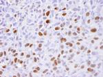 MCM2 Antibody in Immunohistochemistry (Paraffin) (IHC (P))