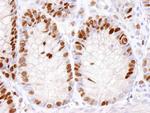 MCM2 Antibody in Immunohistochemistry (Paraffin) (IHC (P))