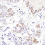 p53 Antibody in Immunohistochemistry (Paraffin) (IHC (P))