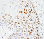 p53 Antibody in Immunohistochemistry (Paraffin) (IHC (P))