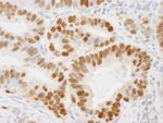 PCNA Polyclonal Antibody