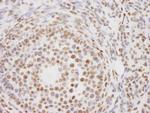 PELP1/MNAR Antibody in Immunohistochemistry (Paraffin) (IHC (P))