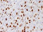 Phospho-MCM2 (Ser108) Antibody in Immunohistochemistry (Paraffin) (IHC (P))