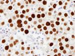 Phospho-MCM2 (Ser108) Antibody in Immunohistochemistry (Paraffin) (IHC (P))