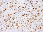 Phospho-MCM2 (Ser41) Antibody in Immunohistochemistry (Paraffin) (IHC (P))