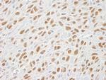 SMC1 Polyclonal Antibody