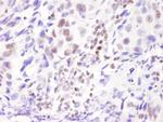 ASC2 Antibody in Immunohistochemistry (Paraffin) (IHC (P))