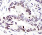 ASC2 Polyclonal Antibody