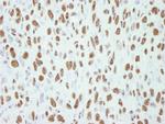 CA150 Antibody in Immunohistochemistry (Paraffin) (IHC (P))
