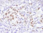 EDD1 Polyclonal Antibody