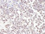MTA1 Antibody in Immunohistochemistry (Paraffin) (IHC (P))