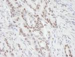 MTA1 Antibody in Immunohistochemistry (Paraffin) (IHC (P))