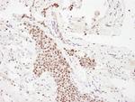 p300 Antibody in Immunohistochemistry (Paraffin) (IHC (P))