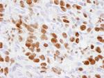 p300 Polyclonal Antibody