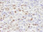 NCOA2/SRC2 Polyclonal Antibody