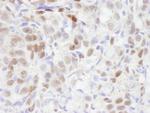 TBLR1 Antibody in Immunohistochemistry (Paraffin) (IHC (P))