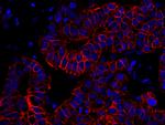 ErbB2 Antibody in Immunohistochemistry (Paraffin) (IHC (P))