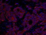 ErbB2 Antibody in Immunohistochemistry (Paraffin) (IHC (P))