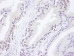 ATM Antibody in Immunohistochemistry (Paraffin) (IHC (P))
