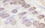 ATM Antibody in Immunohistochemistry (Paraffin) (IHC (P))