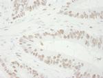 MCM3 Antibody in Immunohistochemistry (Paraffin) (IHC (P))