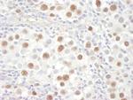 MCM4 Antibody in Immunohistochemistry (Paraffin) (IHC (P))