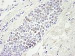 MCM4 Polyclonal Antibody
