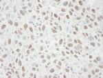 MCM4 Antibody in Immunohistochemistry (Paraffin) (IHC (P))