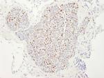 MCM4 Polyclonal Antibody