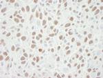 MCM6 Antibody in Immunohistochemistry (Paraffin) (IHC (P))