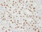 MCM5 Antibody in Immunohistochemistry (Paraffin) (IHC (P))