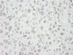 MCM5 Polyclonal Antibody