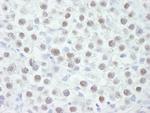 Chk2 Antibody in Immunohistochemistry (Paraffin) (IHC (P))