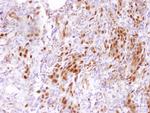 CARM1 Polyclonal Antibody