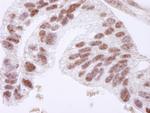 CTCF Polyclonal Antibody