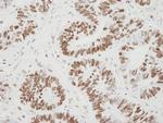 MCM6 Polyclonal Antibody