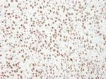 MCM6 Antibody in Immunohistochemistry (Paraffin) (IHC (P))