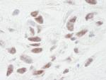 PNUTS Polyclonal Antibody