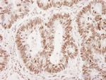 Phospho-53BP1 (Ser25) Antibody in Immunohistochemistry (Paraffin) (IHC (P))