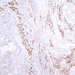 CD31/PECAM-1 Antibody in Immunohistochemistry (Paraffin) (IHC (P))