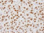 HDAC1 Antibody in Immunohistochemistry (Paraffin) (IHC (P))