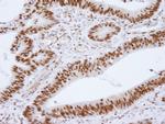 HDAC1 Antibody in Immunohistochemistry (Paraffin) (IHC (P))