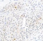 Phospho-gamma-H2AX (Ser139) Antibody in Immunohistochemistry (Paraffin) (IHC (P))