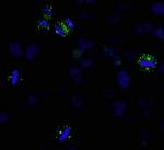 CDK5RAP2 Polyclonal Antibody