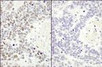 Phospho-MCM2 (Ser53) Antibody in Immunohistochemistry (Paraffin) (IHC (P))