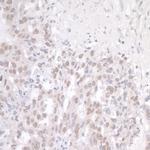 FUS Antibody in Immunohistochemistry (Paraffin) (IHC (P))